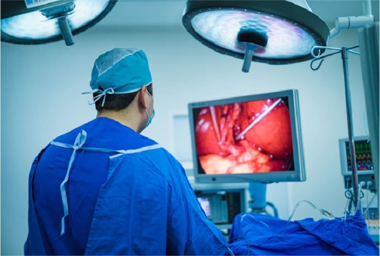 لاپاروسکوپی چیست و چه کاربردی دارد؟